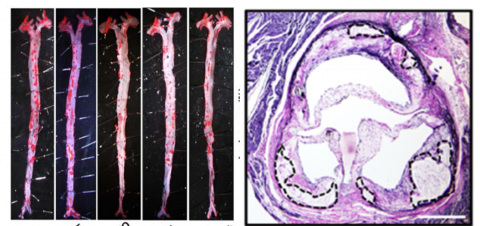 mouse models to study athersclerosis