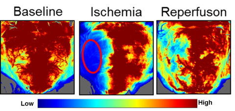 laser speckle imaging